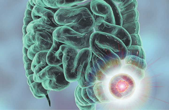 Inzercia Korzár: Prečo je dobré testovať sa na skryté krvácanie ?